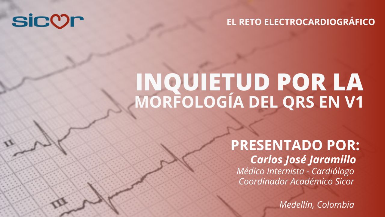 Inquietud por la Morfología del QRS en v1