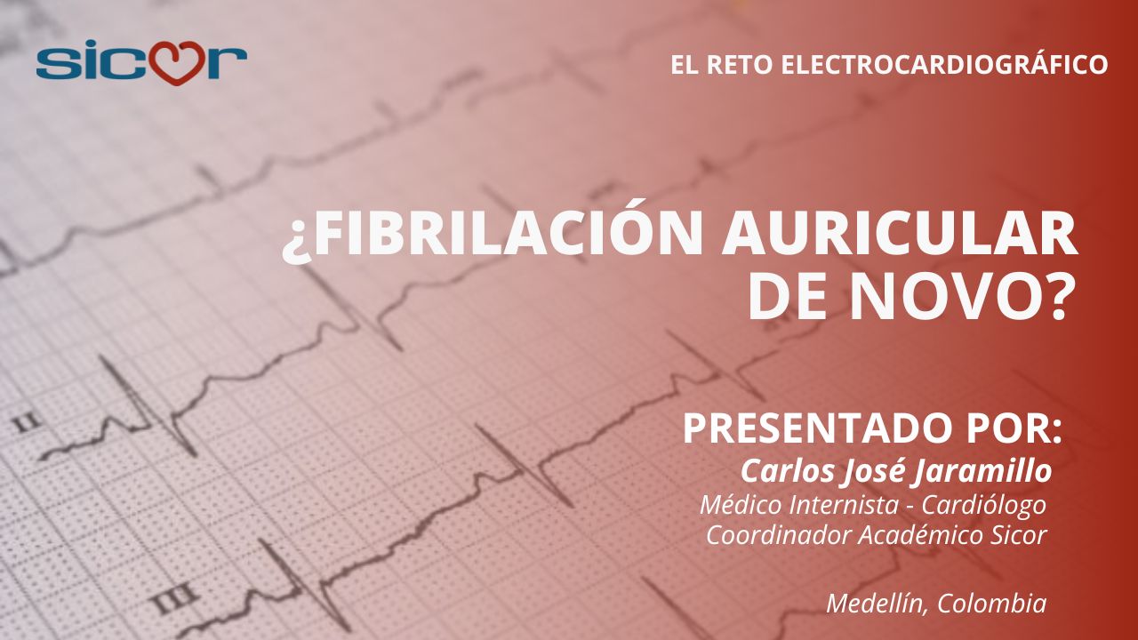 ¿Fibrilación auricular de Novo?