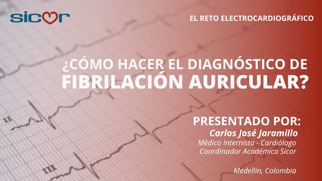Cómo hacer el diagnóstico de fibrilación auricular
