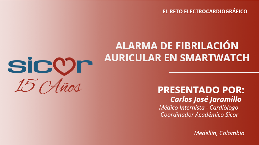 Alarma de fibrilación auricular en Smartwatch